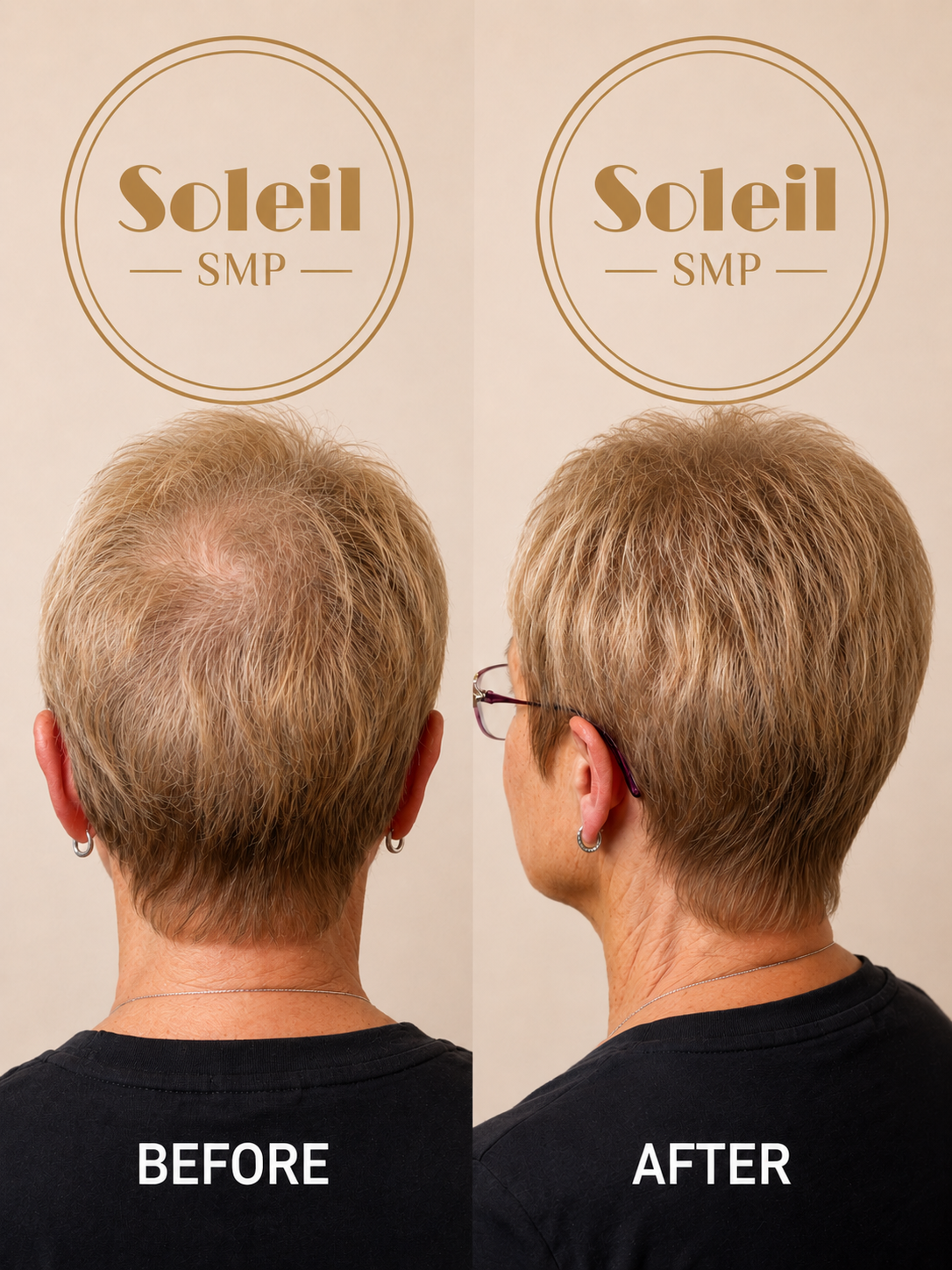 Before treatment